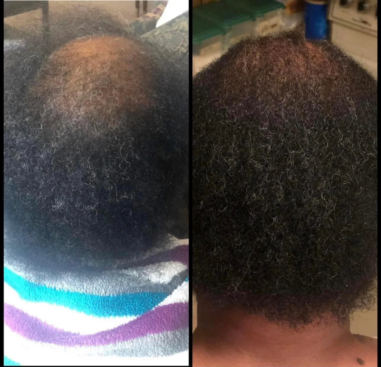 Suiradal Holy Hair Growth Oil
