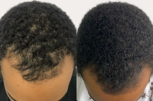 Suiradal Holy Hair Growth Oil